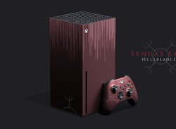 What Xbox Series X Limited Editions Are You Hoping For?